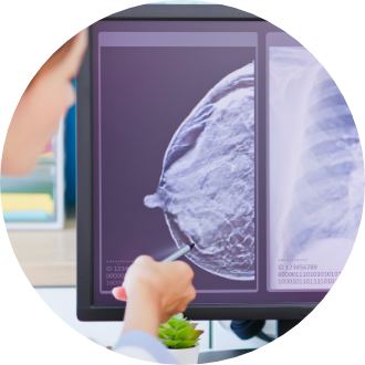 A detailed 3D image of breast tissue, showcasing the clarity and precision of QT imaging technology